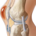 What is Bursitis? How can PT help?